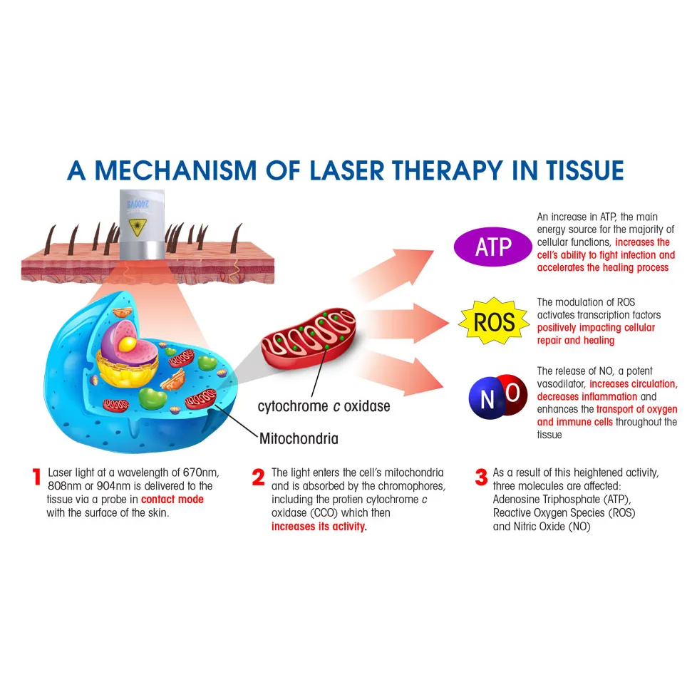 Sieden Home Laser